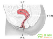 阴道炎